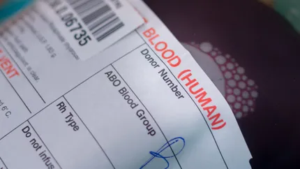 Easy methods to quickly discover your blood type